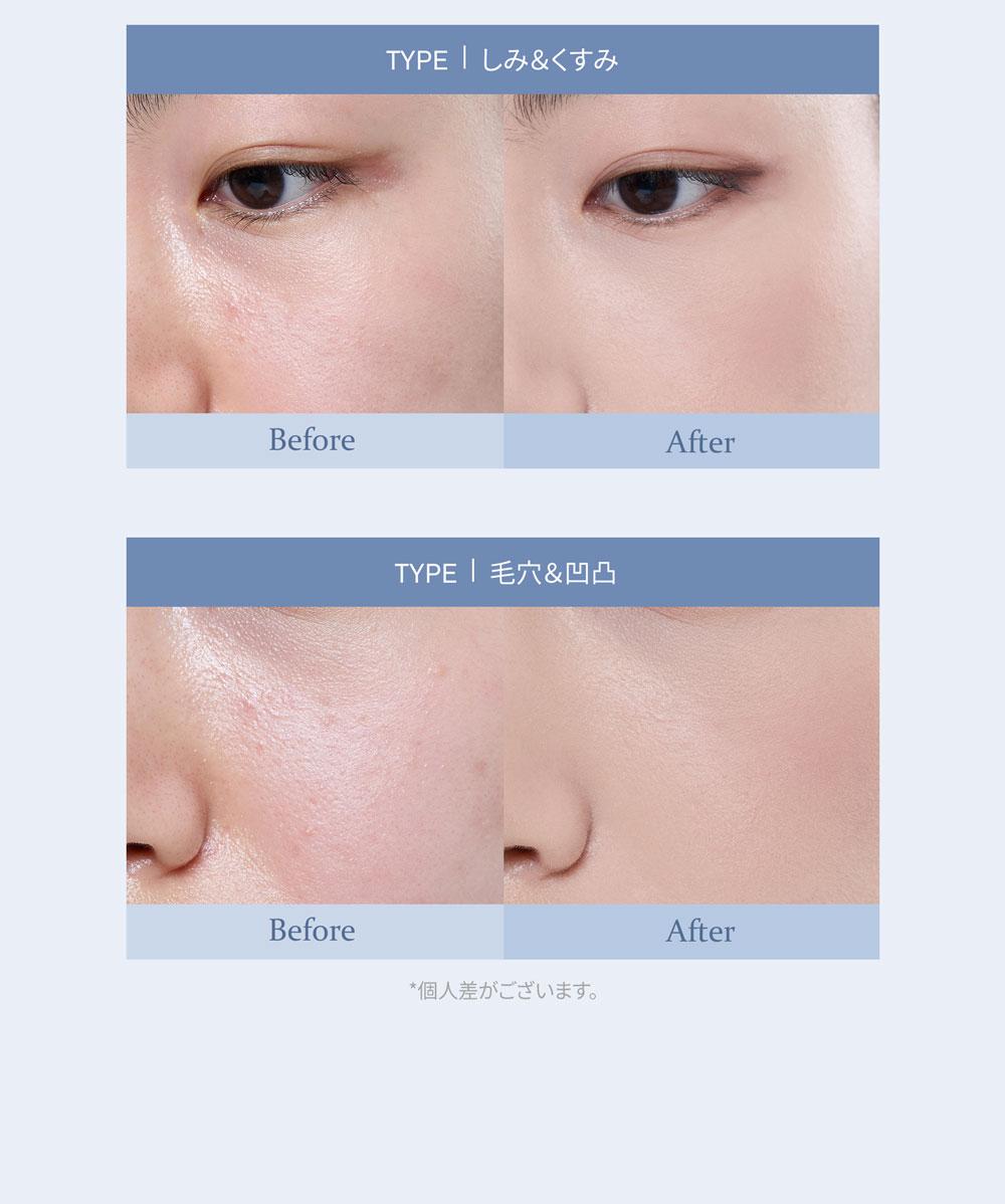 TYPE | しみ＆くすみ Before After TYPE | 毛穴＆凹凸 Before After *個人差がございます。 