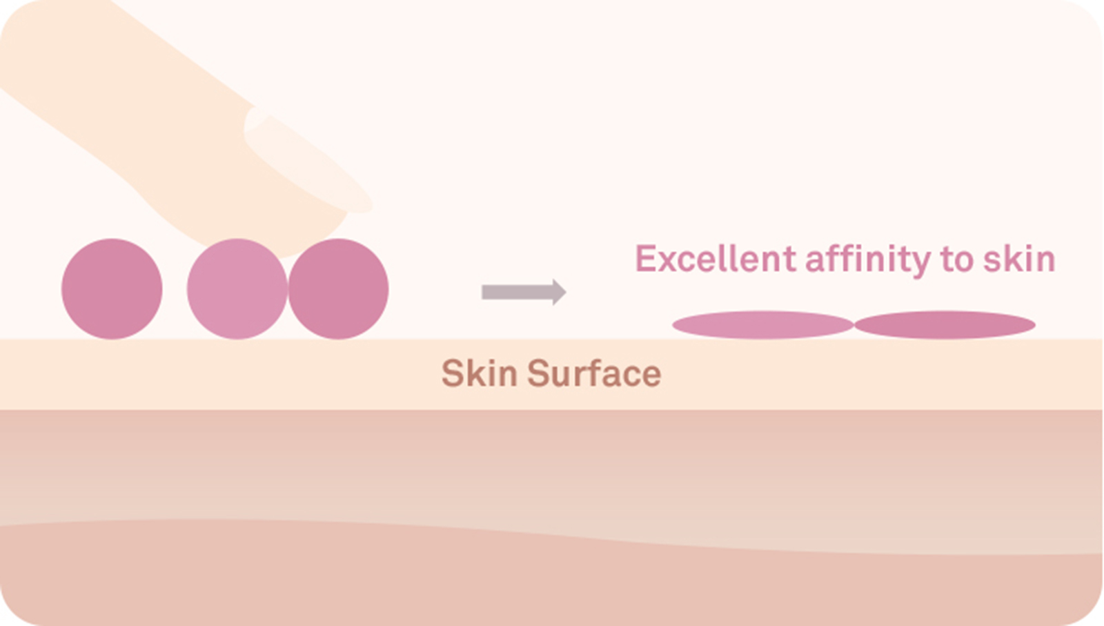 skin surface
